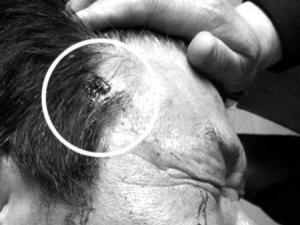 ��ʦ��нȴ��У��ҧͷ��Ѫֱ�� ���������Ѷ��(ͼ)