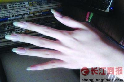 ��һ��������ָ�޳�Ƥ�����������ģ