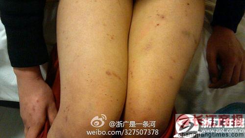 ������������ġ��̹ٱ�ָǿ��Ů�� ����������