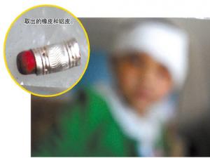 7��Ů���ֳ�Ǧ�ʵ��� Ǧ�ʾ�����Ƥ�²������