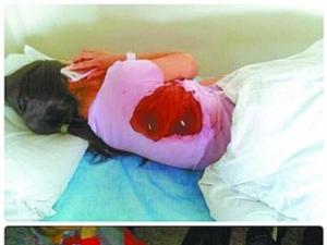 ��ɽͱ�˰��ܺ���ָ���ӷ������⵽��в ������˷����