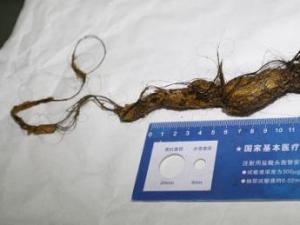 10��Ůͯ��8��ͷ�� θ�л��ɡ�ͷ��ʯ����ͼ�� 