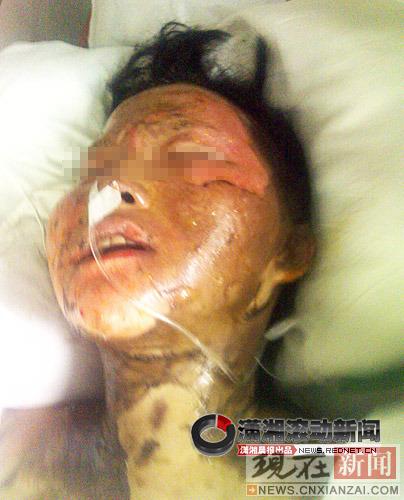 ����ͼƬֱ�����˻��ز�Ǩ��ͻ