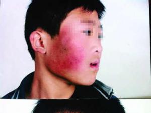 �������Ͽνӻ�������ʦ����������Ѫ(ͼ)