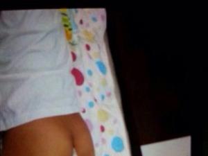 7����ͯ����ʦ���ְ��껼���Բ���ͼ��