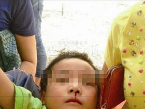 �㽭19��Сѧ����У����ѪŻ�������ж����壨��Ƶ��