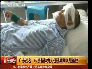 ������˫�۱��ڣ��㶫һ����סԺ�ڼ�˫�۱���