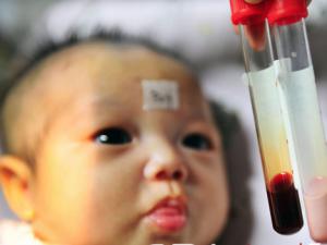 46���Ӥ�����ֲ�ѪҺ���ɫ ������֢��Ȭ��