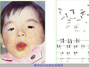 11���к���è���ۺ��������� ȫ�򺱼��������̵�